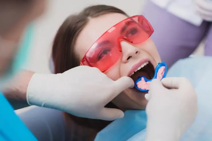 Fluoride Treatments