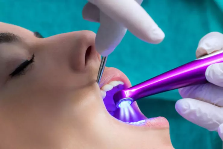 Sealants
